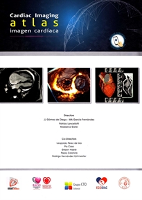 Books Frontpage Atlas de Imagen Cardíaca-Cardiac Imaging Atlas