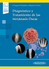 Books Frontpage Diagnóstico y Tratamiento de las Metástasis Óseas