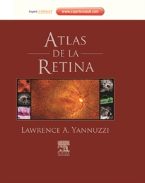 Books Frontpage Atlas de la retina + ExpertConsult