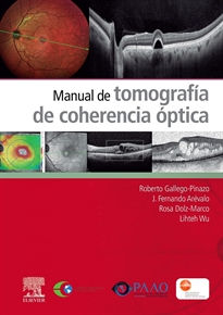 Books Frontpage Manual de tomografía de coherencia óptica