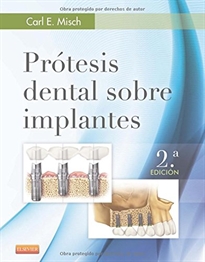 Books Frontpage Prótesis dental sobre implantes