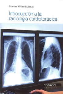 Books Frontpage Introducción a la radiología torácica