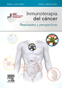 Books Frontpage Inmunoterapia del cáncer. Realidades y perspectivas