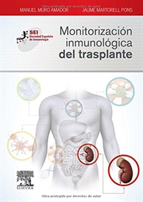 Books Frontpage Monitorización inmunológica del trasplante
