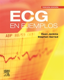 Books Frontpage ECG en ejemplos