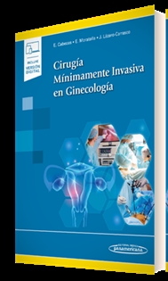 Books Frontpage Cirugía Mínimamente Invasiva en Ginecología