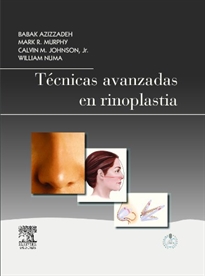 Books Frontpage Técnicas avanzadas en rinoplastia + StudentConsult en español