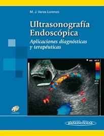 Books Frontpage Ultrasonograf’a Endosc—pica