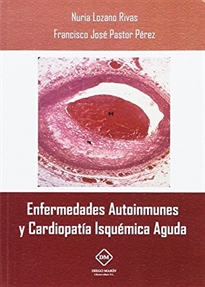 Books Frontpage Enfermedades Autoinmunes Y Cardiopatia Isquemica Aguda